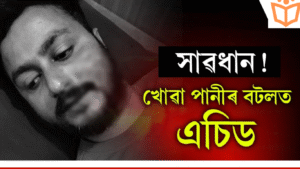 Read more about the article শিৱসাগৰত খোৱাৰ পানীৰ বটলত এচিড! যুৱকজনৰ মুখ-নাক জ্বলি গ’ল, ৰাইজৰ মাজত উৎকণ্ঠা